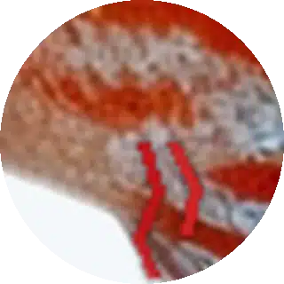 Camallanus and Other Worms close-up