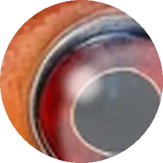 Eye Fluke close-up
